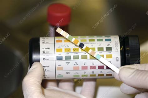 Testing For Blood In A Urine Sample Stock Image M9201538 Science