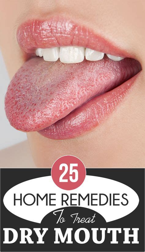 17 Effective Ways To Get Rid Of Dry Mouth Remedies For Dry Mouth Snoring Remedies Holistic