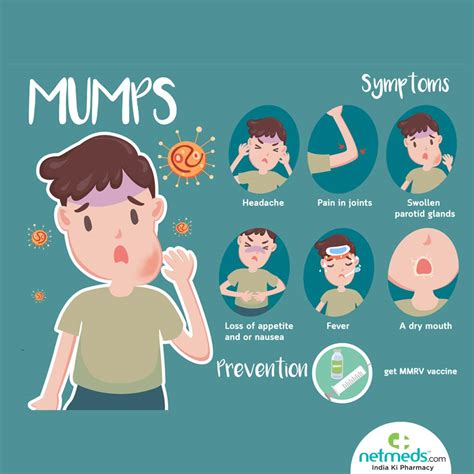 Mumps Causes Symptoms And Treatment Netmeds