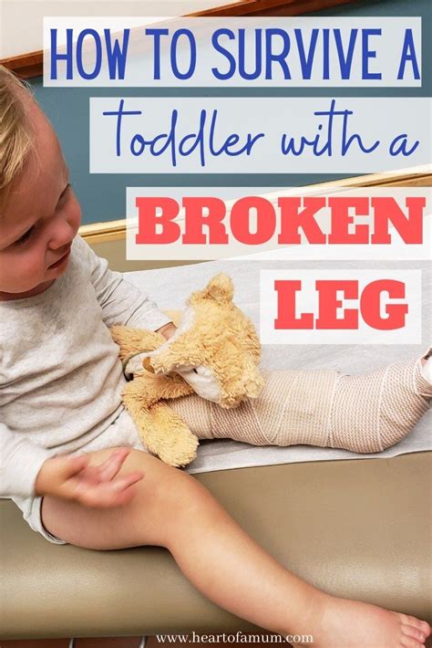 How To Survive A Toddler With A Broken Leg Toddler Broken Leg