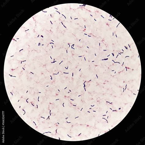 Smear Of Human Blood Culture Grams Stained With Gram Positive Bacilli