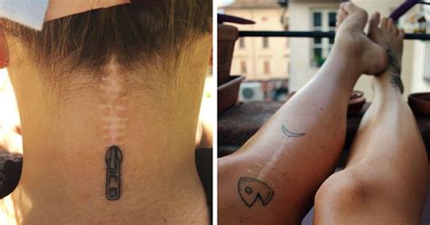 211 Amazing Tattoos That Turn Scars Into Works Of Art Bored Panda