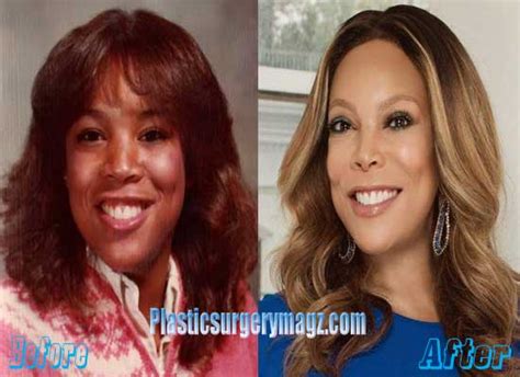 Wendy Williams Plastic Surgery Before And After Plastic Surgery