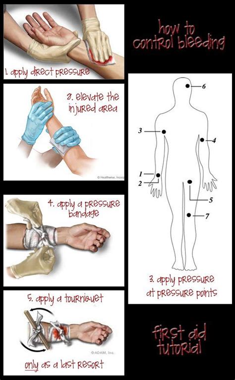 How To Control Bleeding Emergency First Aid Kit Emergency Preparation