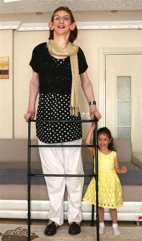 Meet World S Tallest Woman Rumeysa Gelgi Shesight