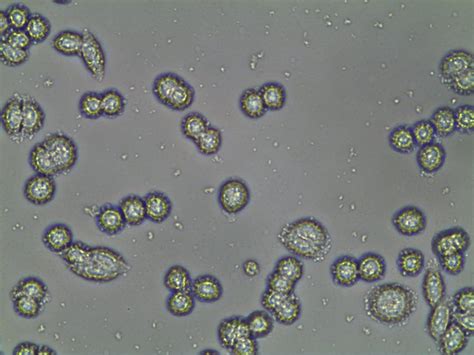 Yeast Fungi Under Microscope Micropedia