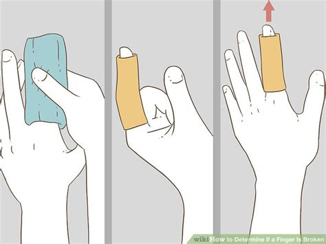 How To Determine If A Finger Is Broken With Pictures Wikihow