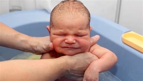 Dry Skin In Newborn Babies How To Adult