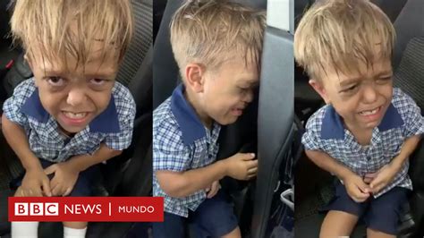 Quaden Bayles El Estremecedor Video De Un Niño De 9 Años Que Dice Querer Suicidarse Por El