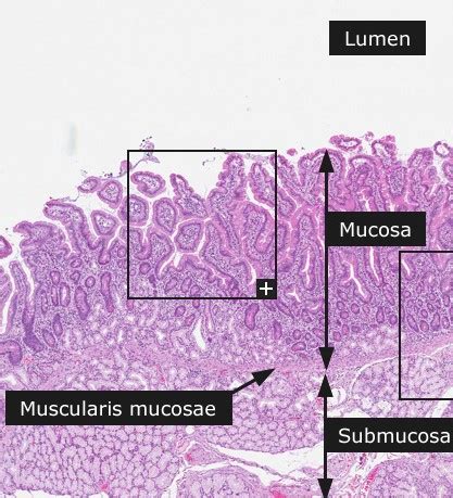 What Is The Histology Of The Duodenum Under The Microscope Study Com