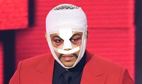 Why Is The Weeknd Wearing Bandages On His Face Did He Get Plastic