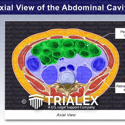 Axial View Of The Abdominal Cavity Trialexhibits Inc