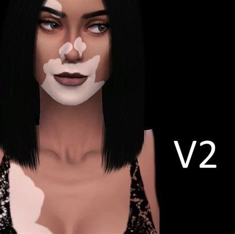 Sims 4 Vitiligo Skin In 2020 Vitiligo Skin Vitiligo