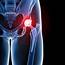Hip Arthritis & Incontinence Symptoms  BallaratOSM