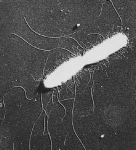 A number of its serovars are serious human pathogens. Salmonella enterica serovar Typhi | bacterium | Britannica.com