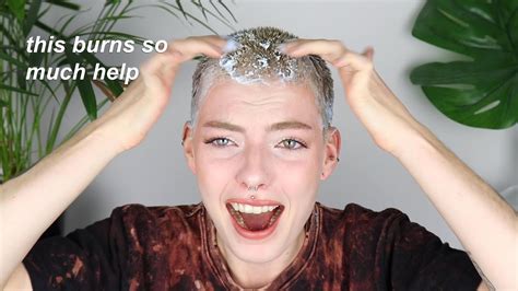 Bleaching And Dyeing My Hair And Accidentally Burning My Scalp Very Painful Lol Youtube