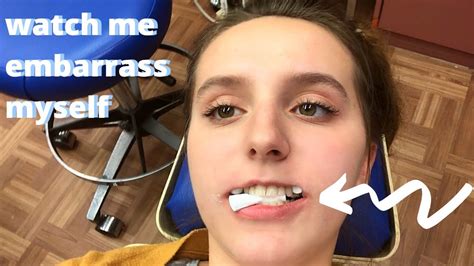 Getting Braces On For The Second Time Vlog Youtube