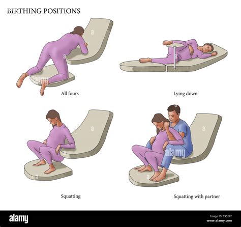 Illustration Of Four Different Birthing Positions All Fours Lying
