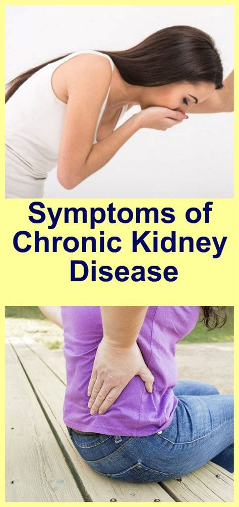 Symptoms Of Chronic Kidney Disease Kidney Disease Diet Chronic