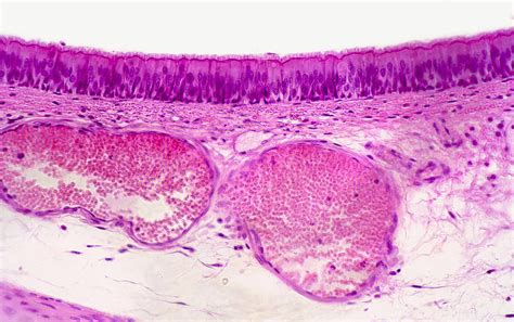 Trachea Showing Ciliated Epithelium Lm Photograph By Science Stock