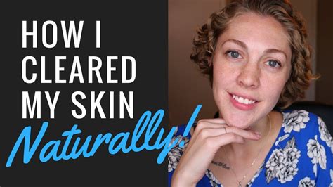 How I Cleared My Skin Naturally Got Rid Of My Acne Youtube