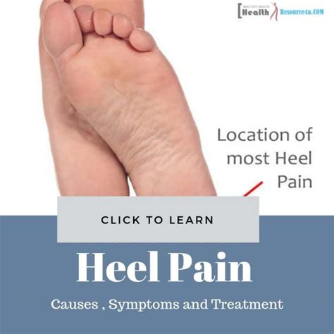 Heel Pain Causes Picture Symptoms And Treatment