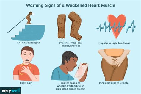Weak Heart Symptoms And Treatments