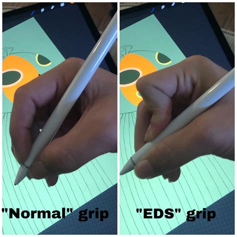 Uslothurknee Because You Asked To See A Visual Difference Between “normal” And “eds” Grips R