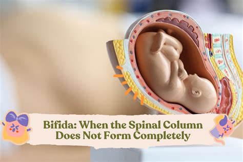 Spina Bifida Causes Symptoms And Treatment