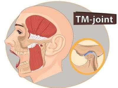 Maybe you would like to learn more about one of these? TMJ and TMD Disorder - Questions and Answers - Dr. Andrew ...