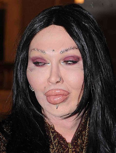 plastic surgery gone very very wrong… 14 pics