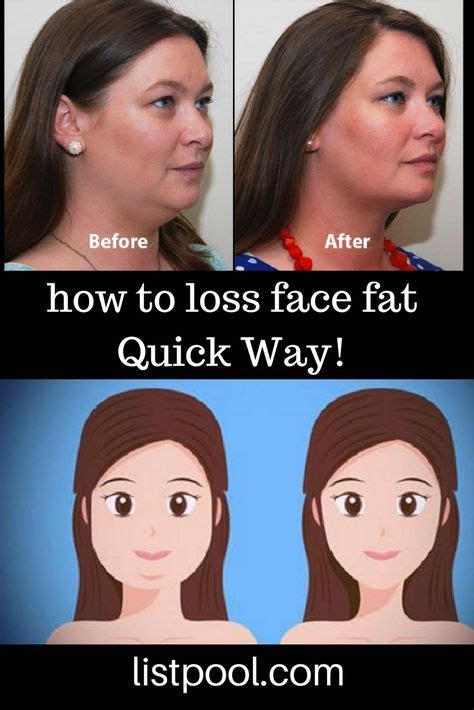 Pin On Face Fat
