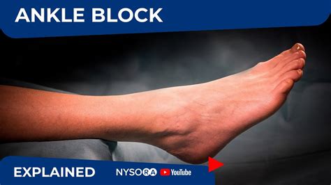 Regional Anesthesia Ultrasound Guided Ankle Block Youtube
