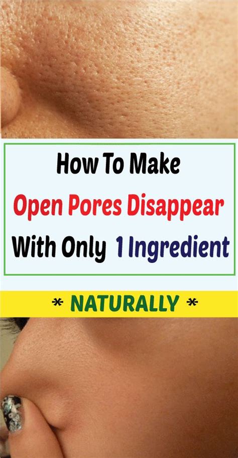 How To Make Open Pores Disappear From Your Skin In Just 3