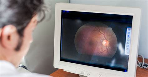 What To Know Before Your Digital Retinal Imaging Exam Revision Optometry