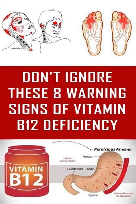 Never Ignore These Warning Signs Of Vitamin B12 Deficiency Remedy Weeks
