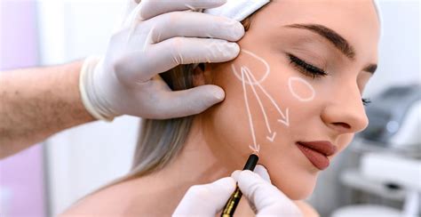 Best Fillers For Cheeks The Bliss Room Medical Spa And Wellness