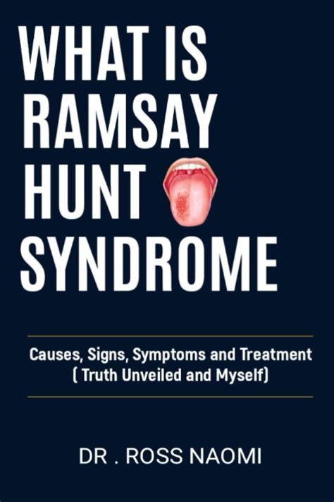 Buy What Is Ramsay Hunt Syndrome Causes Signs Symptoms And Truth