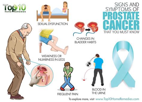 Signs And Symptoms Of Prostate Cancer Top 10 Home Remedies