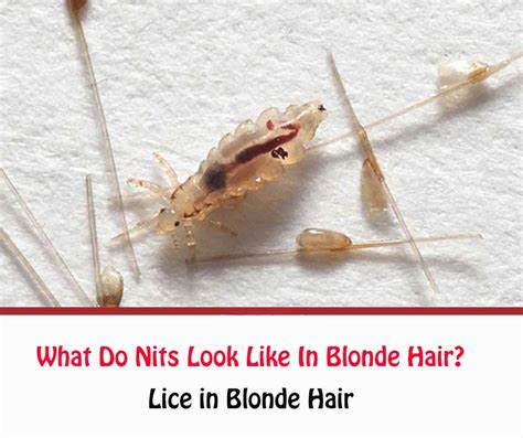 What Do Nits Look Like In Blonde Hair How To Get Rid Of All Things