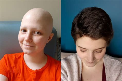 My Hair Growth After Chemo Griffblog Uk Fashion Lifestyle