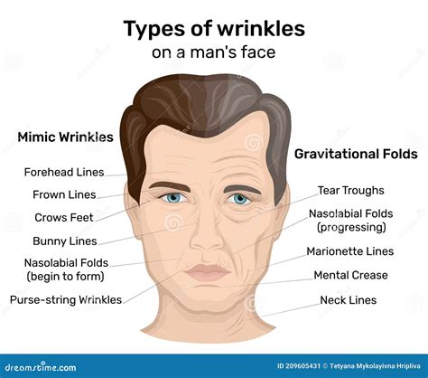 Types Of Wrinkles On A Man`s Face Stock Vector Illustration Of Crows