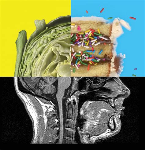 New Study Reveals Key Differences In Brain Activity In People With