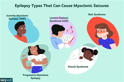 Myoclonic Seizures Symptoms Causes And Treatment