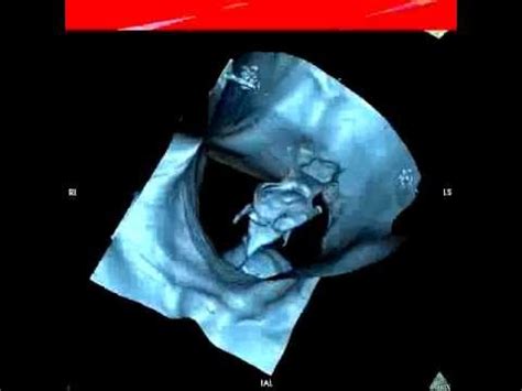 Physical signs a cat is nearing death. CT scan injured throat 3D-7 - YouTube