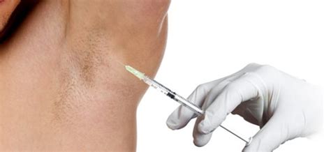 Botox For Hyperhidrosis Exactly Why This Is The Best Option Available