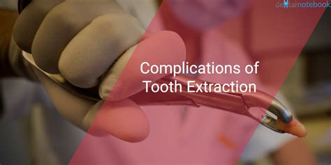 Maxillary canine tooth extraction in the dog. Complications of Tooth Extraction - dentalnotebook