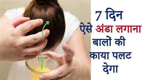 7 दिन ऐसे अंडा लगाना बालों की काया पलट देगा How To Use Egg On Hair Hindi Youtube