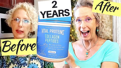 collagen before and after results after 2 years using collagen peptides daily youtube