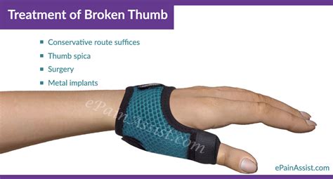 Broken Thumb Treatment Exercises Causes Symptoms Risk Factors
